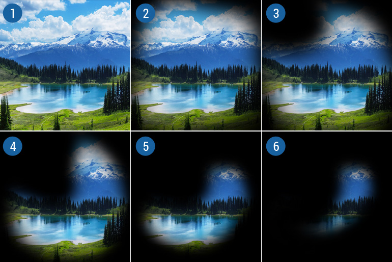 Открытоугольная глаукома - причины и симптомы. Лечение открытоугольной ...